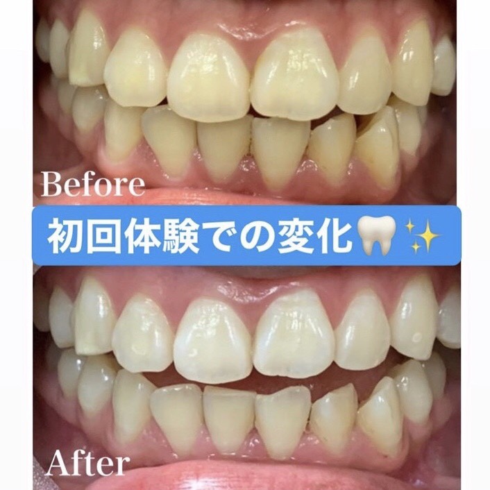 忘年会など人と会うことが多い季節！あなたの「歯」大丈夫ですか？