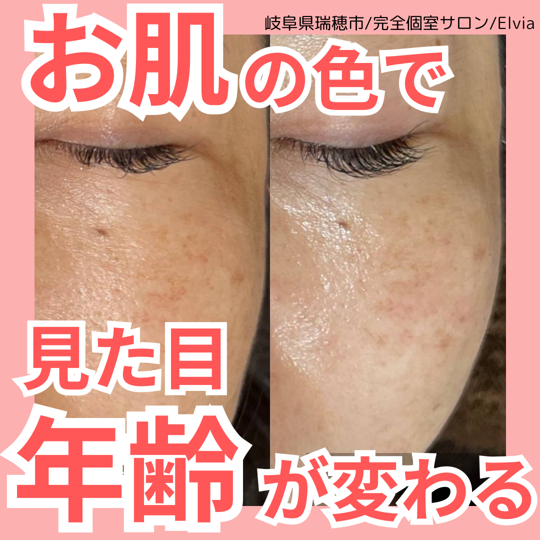 お肌で見た目年齢が変わる！