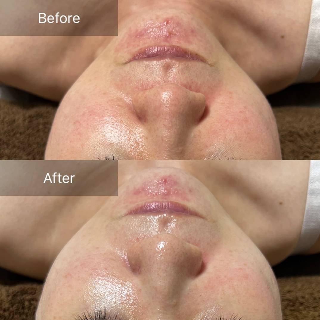 2024年は新しい自分に！！REVI陶肌トリートメント