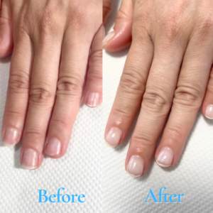 自爪育成サロン 瑞穂市ネイルサロン#岐阜ネイルサロン #大垣ネイルサロン #完全個室ネイルサロン #グリーンネイル補修 #美爪育成サロン #貝爪 #深爪 #自爪育成サロン #爪の形を綺麗にするサロン #ルビケイト岐阜講師