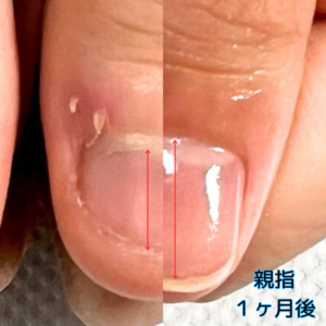 自爪育成サロン 瑞穂市ネイルサロン#岐阜ネイルサロン #大垣ネイルサロン #完全個室ネイルサロン #グリーンネイル補修 #美爪育成サロン #貝爪 #深爪 #自爪育成サロン #爪の形を綺麗にするサロン #ルビケイト岐阜講師