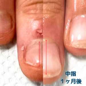 自爪育成サロン 瑞穂市ネイルサロン#岐阜ネイルサロン #大垣ネイルサロン #完全個室ネイルサロン #グリーンネイル補修 #美爪育成サロン #貝爪 #深爪 #自爪育成サロン #爪の形を綺麗にするサロン #ルビケイト岐阜講師