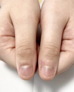 自爪育成サロン 瑞穂市ネイルサロン#岐阜ネイルサロン #大垣ネイルサロン #完全個室ネイルサロン #グリーンネイル補修 #美爪育成サロン #貝爪 #深爪 #自爪育成サロン #爪の形を綺麗にするサロン #ルビケイト岐阜講師