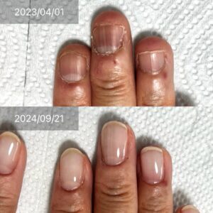 深爪の方必見 深爪矯正が大事 自爪育成サロン 瑞穂市ネイルサロン#岐阜ネイルサロン #大垣ネイルサロン #完全個室ネイルサロン #グリーンネイル補修 #美爪育成サロン #貝爪 #深爪 #自爪育成サロン #爪の形を綺麗にするサロン #ルビケイト岐阜講師